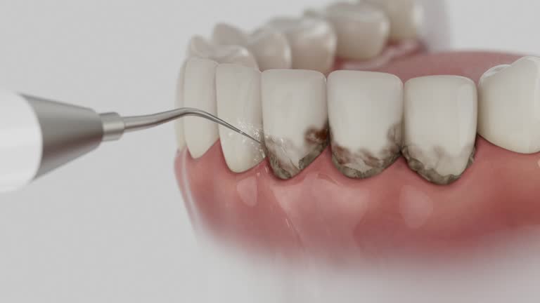 Reliable Tooth Extraction contractor in Morton County County, KS by Dentist Open Now
